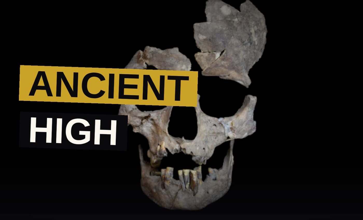 An ancient skull with worn teeth, revealing deep grooves from centuries of betel nut chewing.