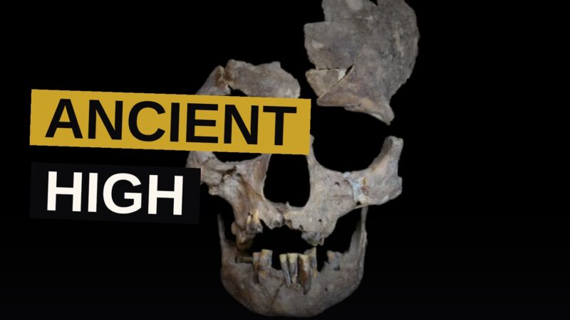 An ancient skull with worn teeth, revealing deep grooves from centuries of betel nut chewing.